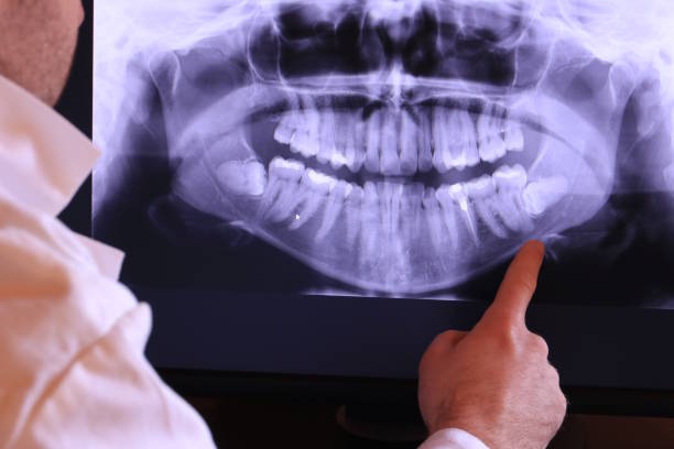Best Emergency Treatment for Toothache in Cedaredge, CO