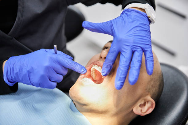 Best Emergency Tooth Extraction in Cedaredge, CO
